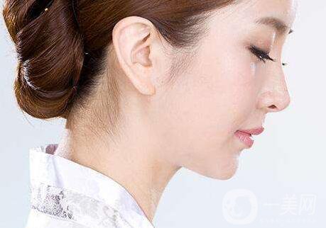 隆鼻危險嗎?隆鼻危險大嗎？