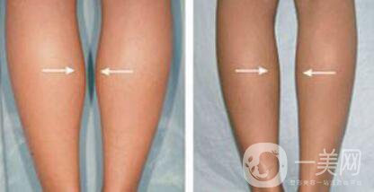 **多少錢 **具體價(jià)格介紹