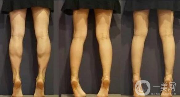 **多少錢 **具體價(jià)格介紹