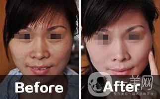 黑臉娃娃價格多少 收費標準介紹