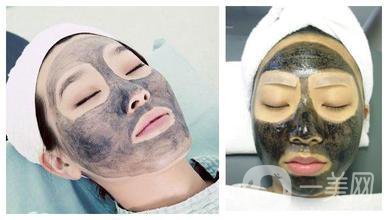 黑臉娃娃做一次多少錢 正規(guī)醫(yī)院收費(fèi)多少錢？