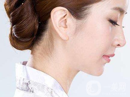 廣東鼻翼寬整形多少錢(qián) 鼻翼寬整形價(jià)格