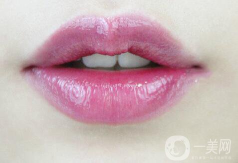 豐唇需要多少錢(qián) 豐唇價(jià)格詳解