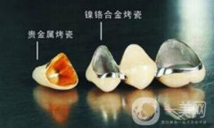 上海鈷鉻烤瓷牙價格 鈷鉻烤瓷牙要多少錢