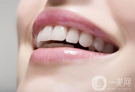 非金屬烤瓷牙價格一般是多少？