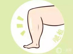 注射瘦腿價格 注射瘦腿多少錢