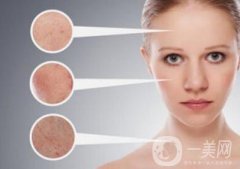 *風范祛斑多少錢一次 與哪些因素有關(guān)？