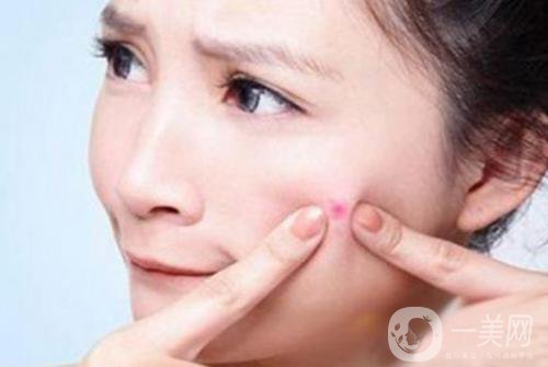 像素激光祛痘疤費(fèi)用一般要多少錢？