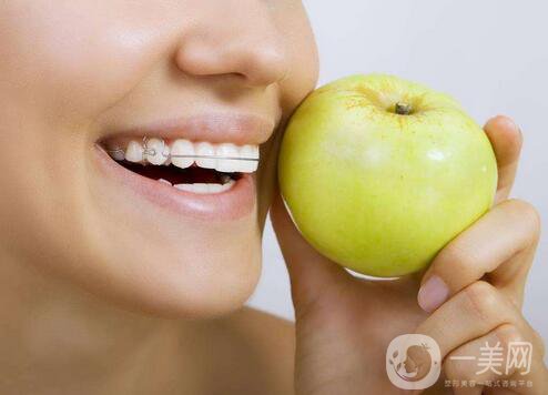 t4a牙齒矯正器*果好不好 有哪些作用