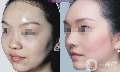 *恢復(fù)期注意事項 *術(shù)后護理