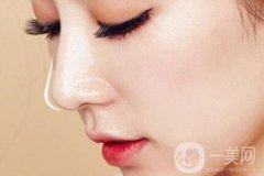 隆鼻山根多久消腫定型 隆鼻后多久完全恢復(fù)