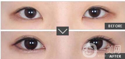 上海九院整形科,價(jià)格表