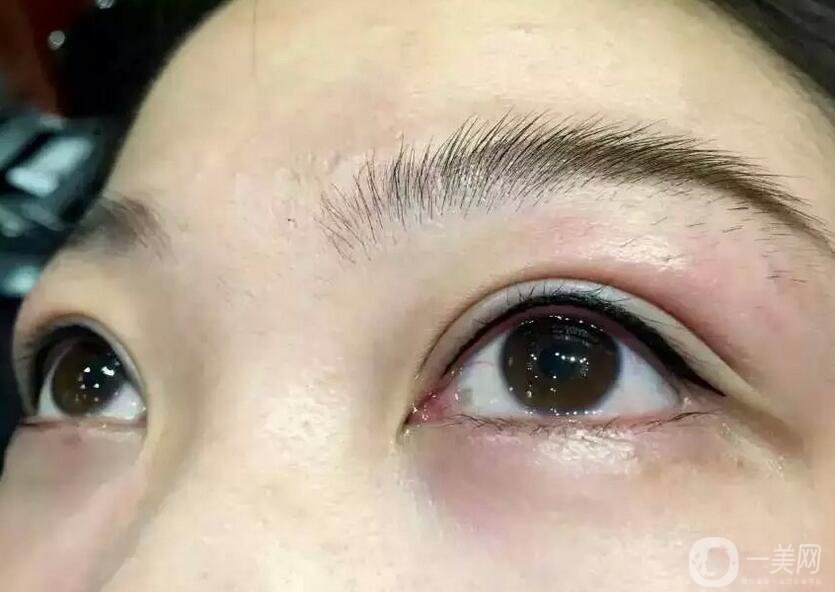 洗眼線多少錢 洗眼線具體價(jià)格多少