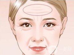 怎么樣去掉抬頭紋 去抬頭紋方法有哪些