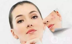 做一次果酸換膚大概需要多少錢？