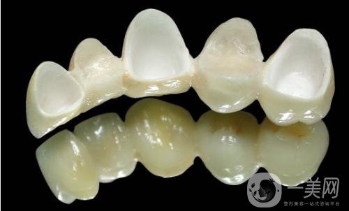 做美容冠矯正齙牙多少錢？