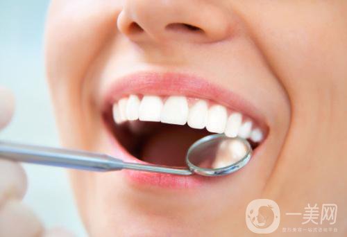 做美容冠矯正齙牙多少錢？