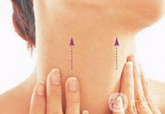 怎么去頸紋 如何去除頸紋