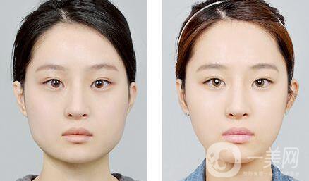 *,多少錢(qián)一針