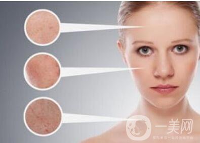 c6激光祛斑,多少錢(qián)