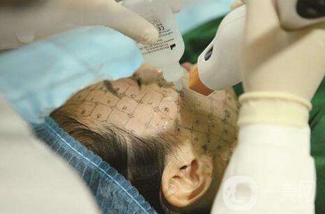 thermage熱瑪吉緊膚一次多少錢？