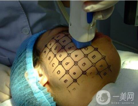 thermage熱瑪吉緊膚一次多少錢？