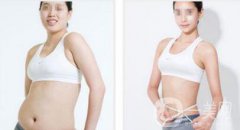 水動力溶脂減肥靠譜嗎 水動力溶脂減肥怎么樣