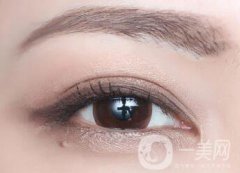 不開刀的雙眼皮方式有哪幾種？