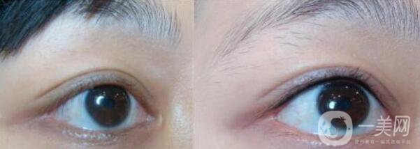 洗眼線(xiàn)較好的方法 怎么洗眼線(xiàn)*果好