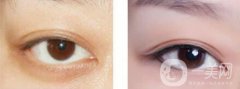 洗眼線多久能恢復(fù)  洗眼線幾天能好