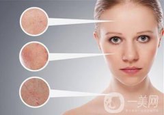 c6激光美容怎么樣 c6激光美容好不好