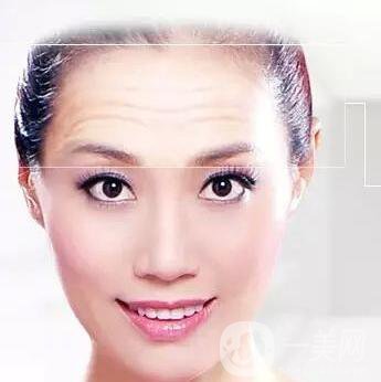 怎么消掉抬頭紋 抬頭紋怎么消掉