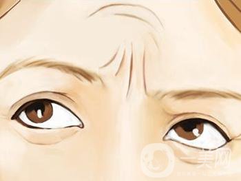 怎么去抬頭紋比較*果？