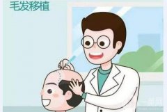 fut植發(fā)怎么樣 fut植發(fā)好不好