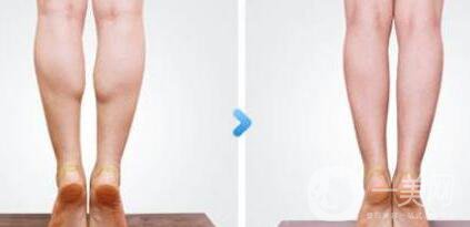 **的價(jià)格 **費(fèi)用介紹