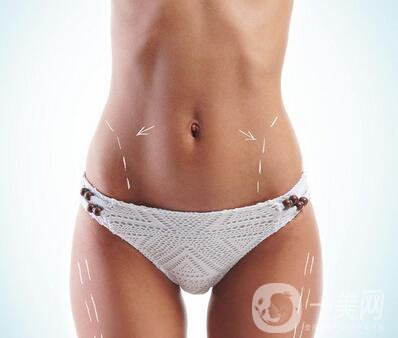 腰腹部吸脂多久見*果？需要多久時(shí)間？