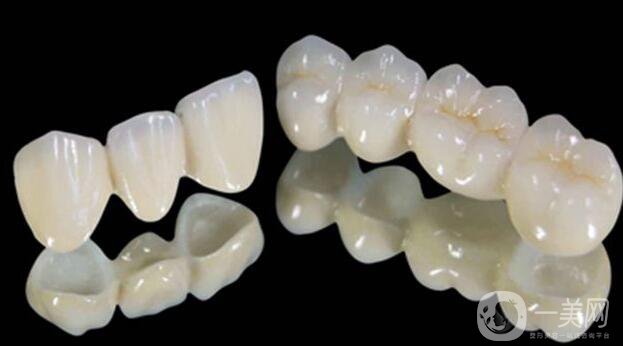 鈀銀合金烤瓷牙,優(yōu)缺點(diǎn)