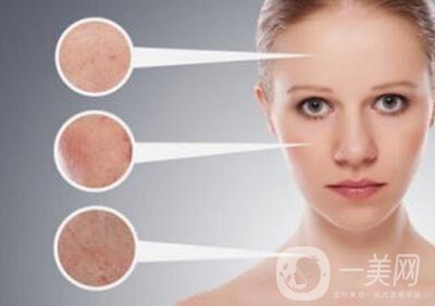 *風(fēng)范祛斑*果怎么樣？