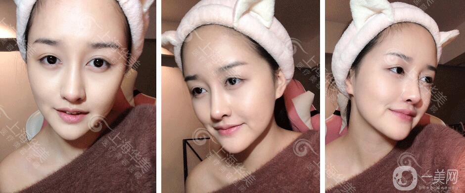 上海華美整形價(jià)格表2018發(fā)布 高級(jí)臉專(zhuān)屬定制項(xiàng)目曝光