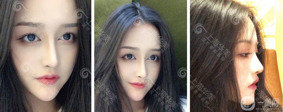 上海華美整形價(jià)格表2018發(fā)布 高級(jí)臉專(zhuān)屬定制項(xiàng)目曝光