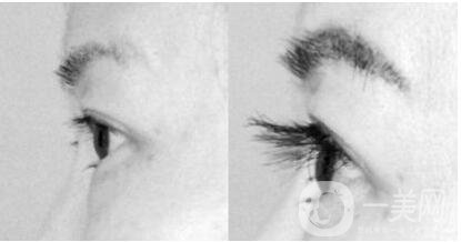 深圳,移植睫毛,多少錢