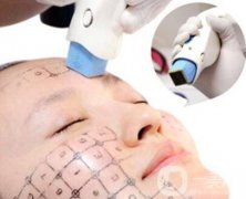 熱瑪吉除皺價(jià)格是多少錢(qián)？