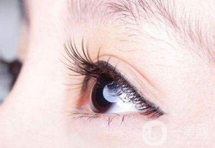 睫毛移植*果怎么樣？