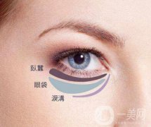 吸脂去下眼瞼眼袋怎么樣？
