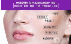 激光祛斑的危害與果分別有哪些？