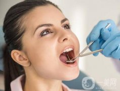 成都種植牙信息介紹？