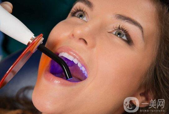 *潔牙注意事項有哪些？