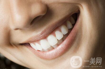 廣州種植牙價(jià)格是多少？