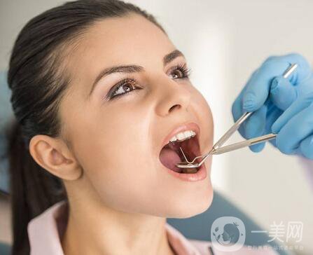 上海九院種植牙價(jià)格是多少？