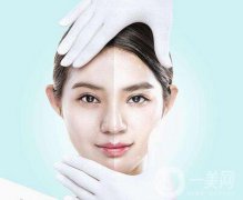 像束激光美白嫩膚功有哪些？